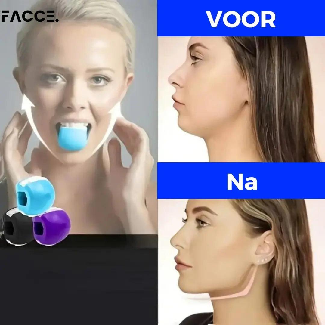 FacceMaster Pro™ Kaaktrainer - Voor de Perfecte Kaaklijn - FACCE. Amsterdam