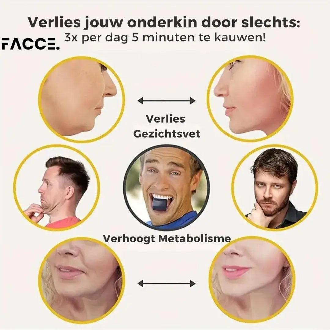 FacceMaster Pro™ Kaaktrainer - Voor de Perfecte Kaaklijn - FACCE. Amsterdam