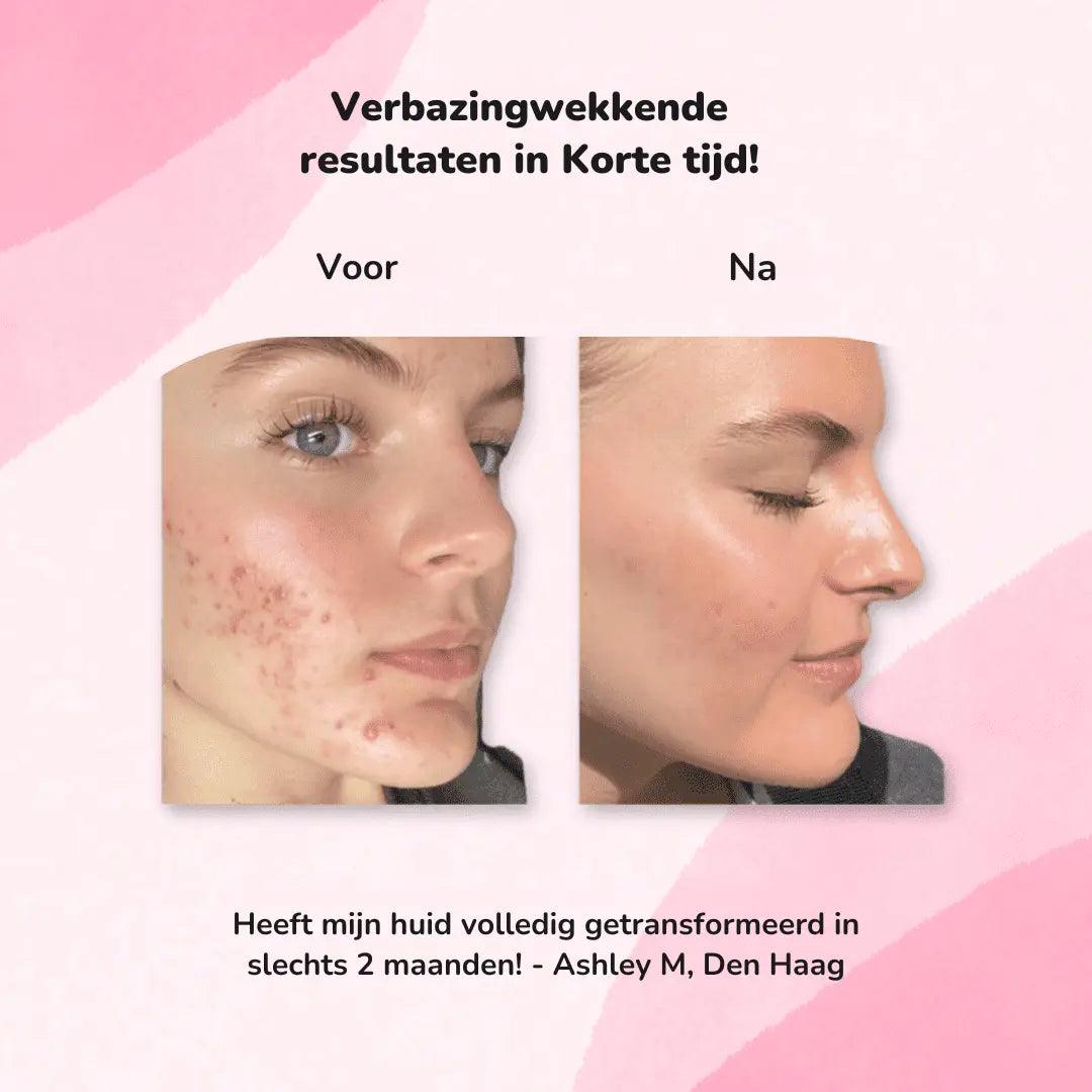 FaccePads™ | Kurkuma Kojic Acid Pads - FACCE. Amsterdam