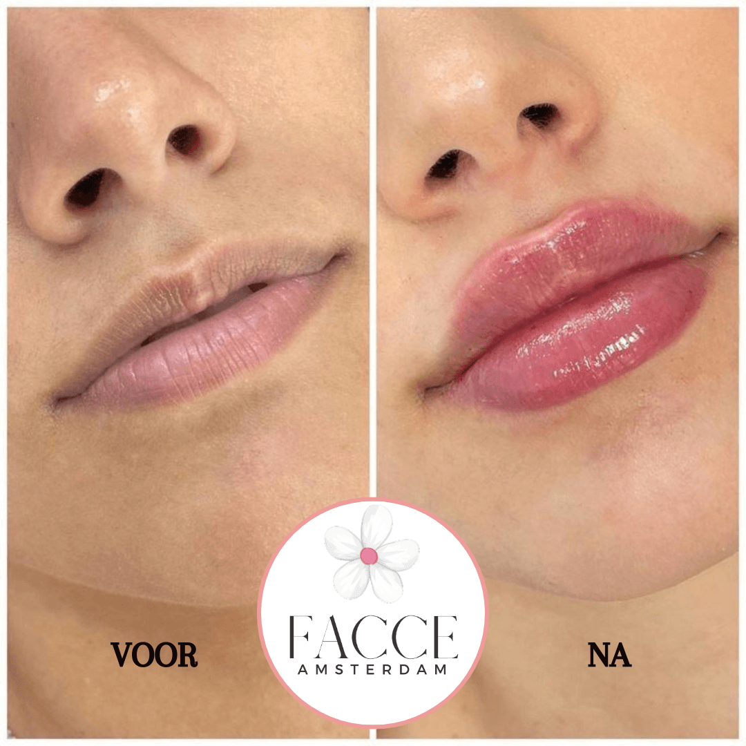 Lip Liner Stain™ | Peel & Reveal - FACCE. Amsterdam